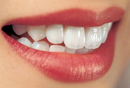 răng đẹp
