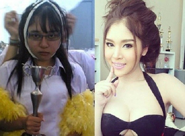 Loạt ảnh trước và sau phẫu thuật thẩm mỹ của những cô gái Thái 15