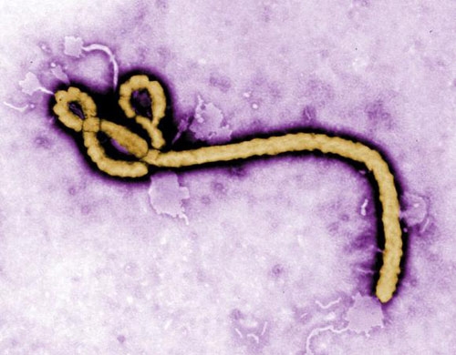 Ebola diễn biến phức tạp, thêm 1 bác sỹ tử vong - 3