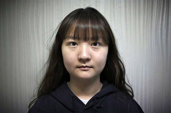  Nỗi đau đớn của thiếu nữ Hàn Quốc khi phẫu thuật thẩm mỹ 5