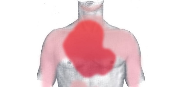 8 kỹ năng cấp cứu quan trọng hô hấp nhân tạo ép tim đau tim tắc thở dị vật chết đuối cầm máu bỏng hộ sản