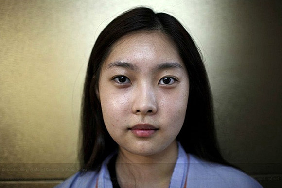  Nỗi đau đớn của thiếu nữ Hàn Quốc khi phẫu thuật thẩm mỹ 12