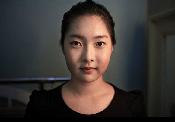  Nỗi đau đớn của thiếu nữ Hàn Quốc khi phẫu thuật thẩm mỹ 4