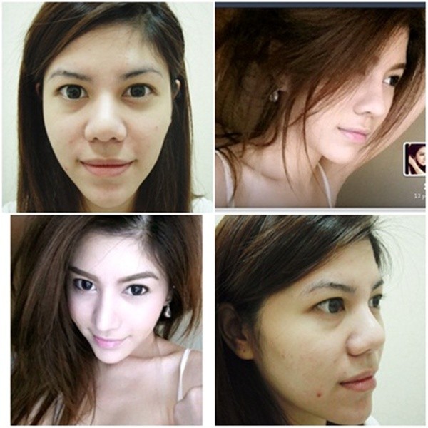 Loạt ảnh trước và sau phẫu thuật thẩm mỹ của những cô gái Thái 3