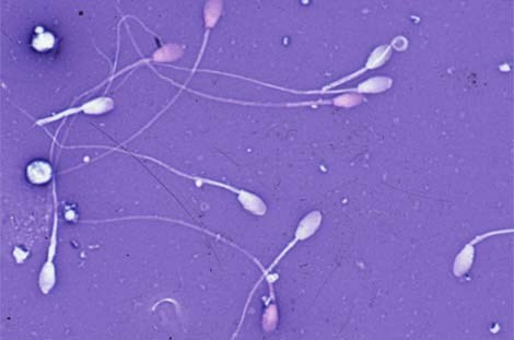 9 điều cần biết về dị ứng tinh trùng