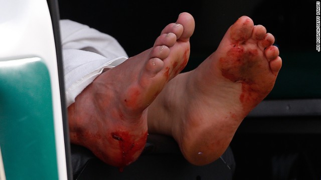 A man's blood-stained feet hang outside an ambulance.