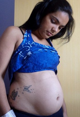 Mang thai 41 tuần, mổ đẻ phát hiện tử cung... không có em bé 3